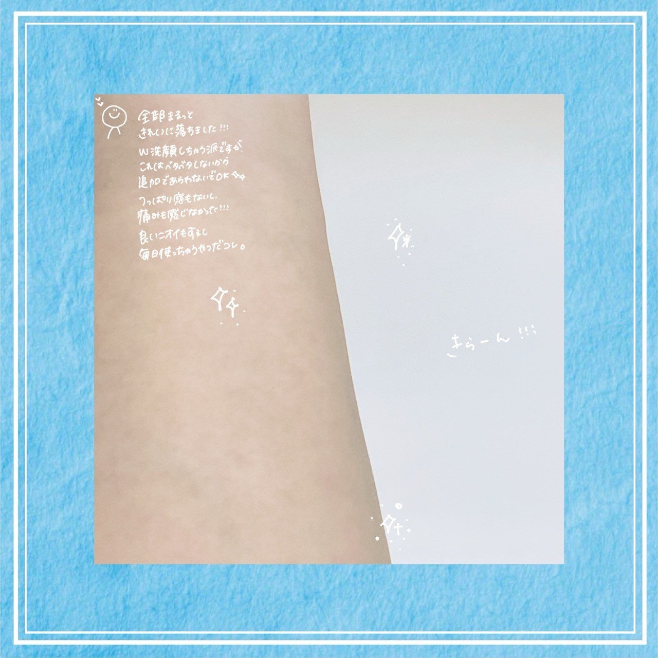 センテラ ライトクレンジングオイル/SKIN1004/オイルクレンジングを使ったクチコミ(7枚目)