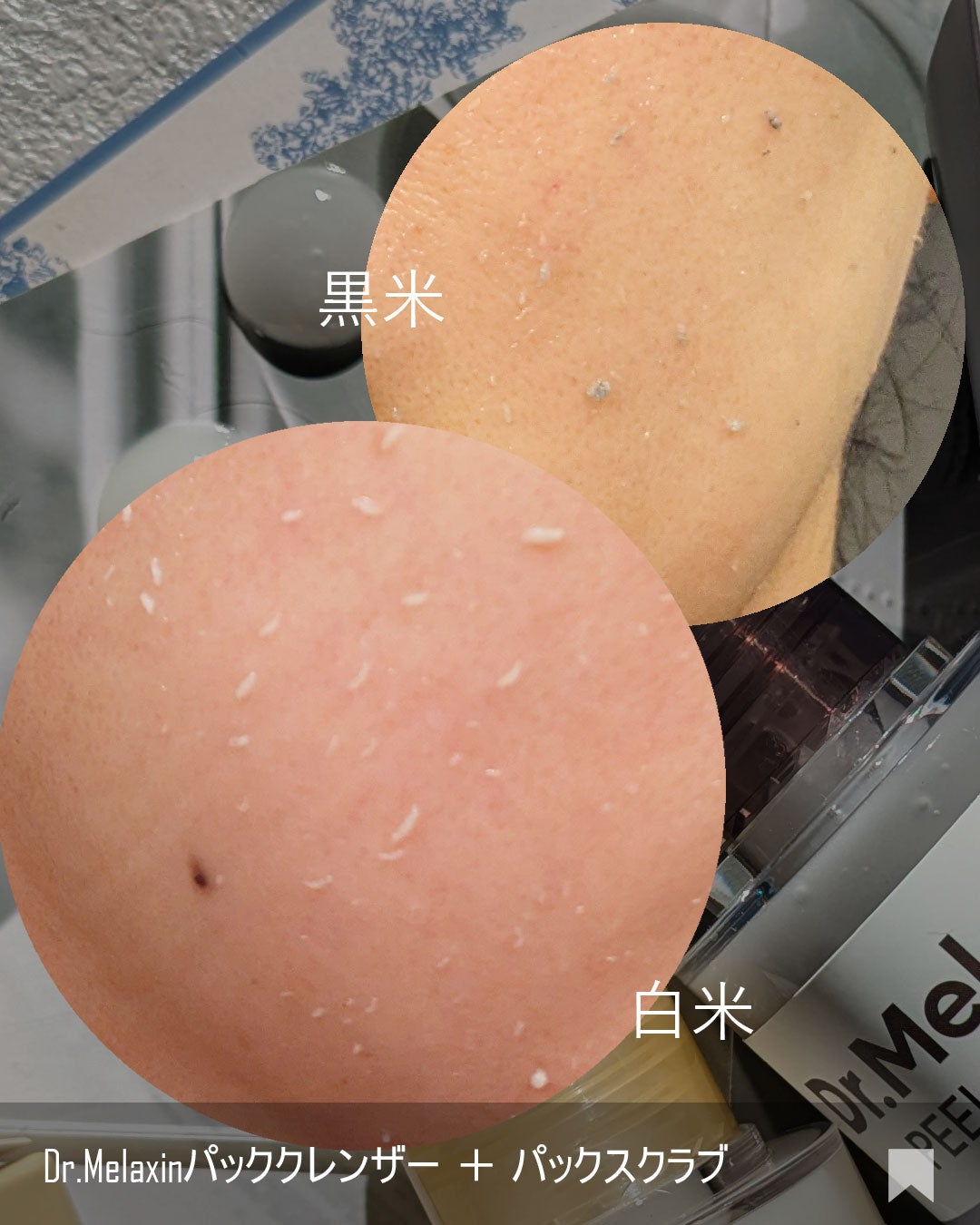 白米ピールショットゴマージュアンプル/Dr.Melaxin/美容液を使ったクチコミ(5枚目)