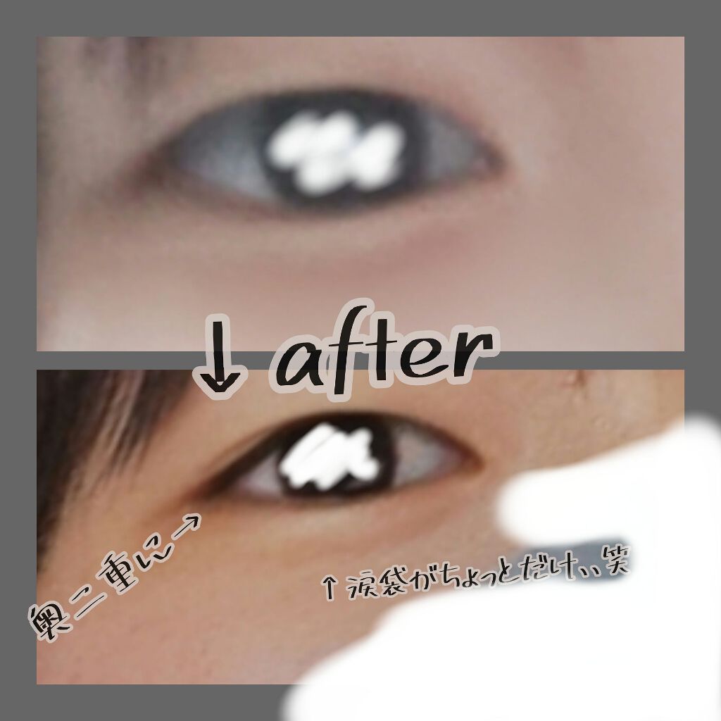 アイビューティー フィクサー WP/アストレア ヴィルゴ/二重まぶた用アイテムを使ったクチコミ（3枚目）