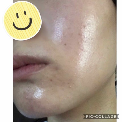 ソニック システム ピュリファイング クレンジング ブラシ/CLINIQUE/美顔器・マッサージを使ったクチコミ(4枚目)