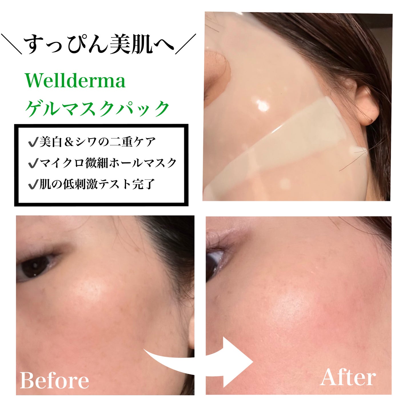 プレミアムシカトリートメントフィッティングマスクパック/WellDerma/シートマスク・パックを使ったクチコミ(1枚目)