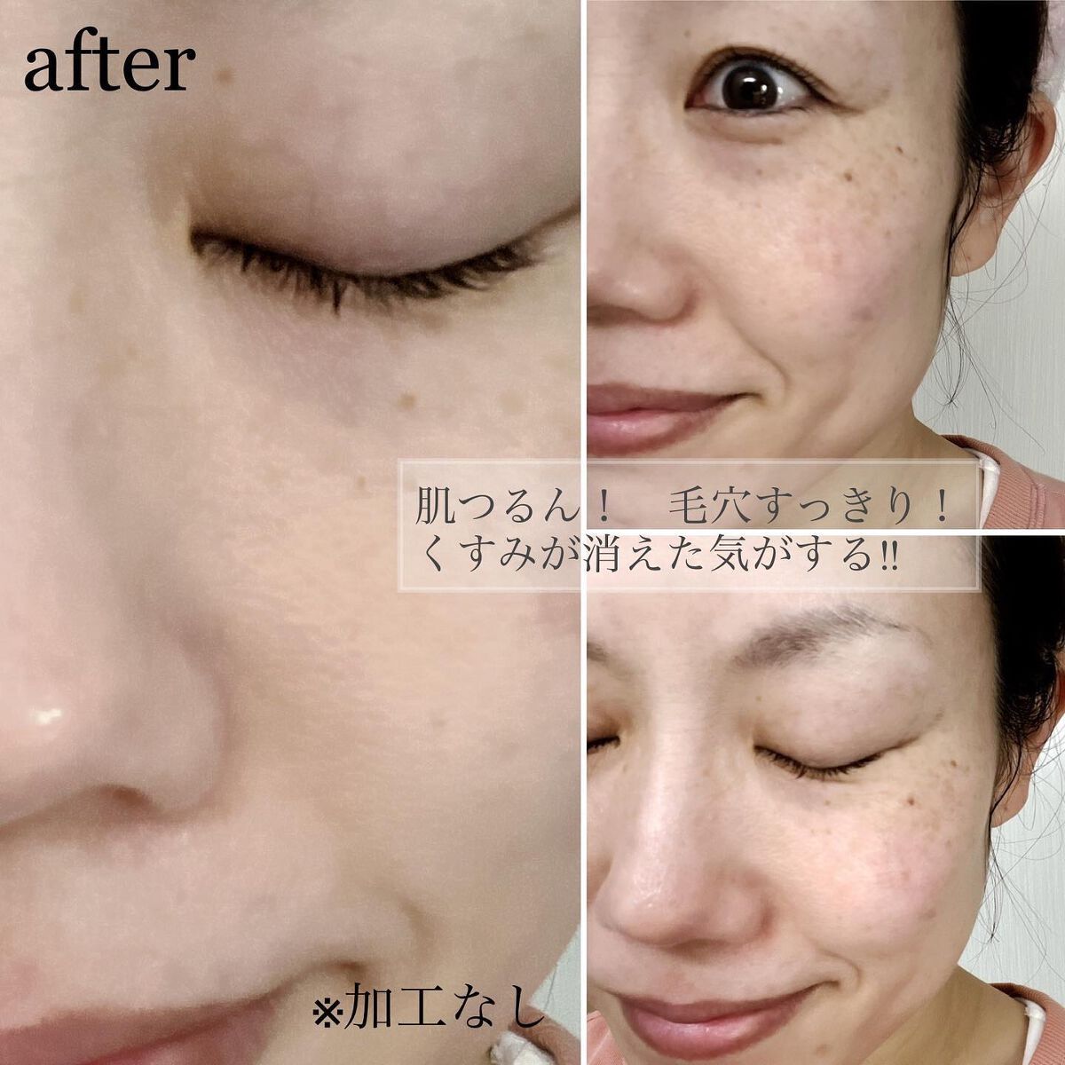 ダヴ 吸着毛穴ケア 洗顔ジェル/ダヴ/その他洗顔料を使ったクチコミ(6枚目)