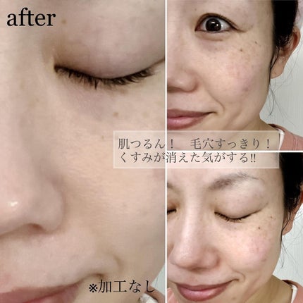 ダヴ 吸着毛穴ケア 洗顔ジェル/ダヴ/その他洗顔料を使ったクチコミ(6枚目)