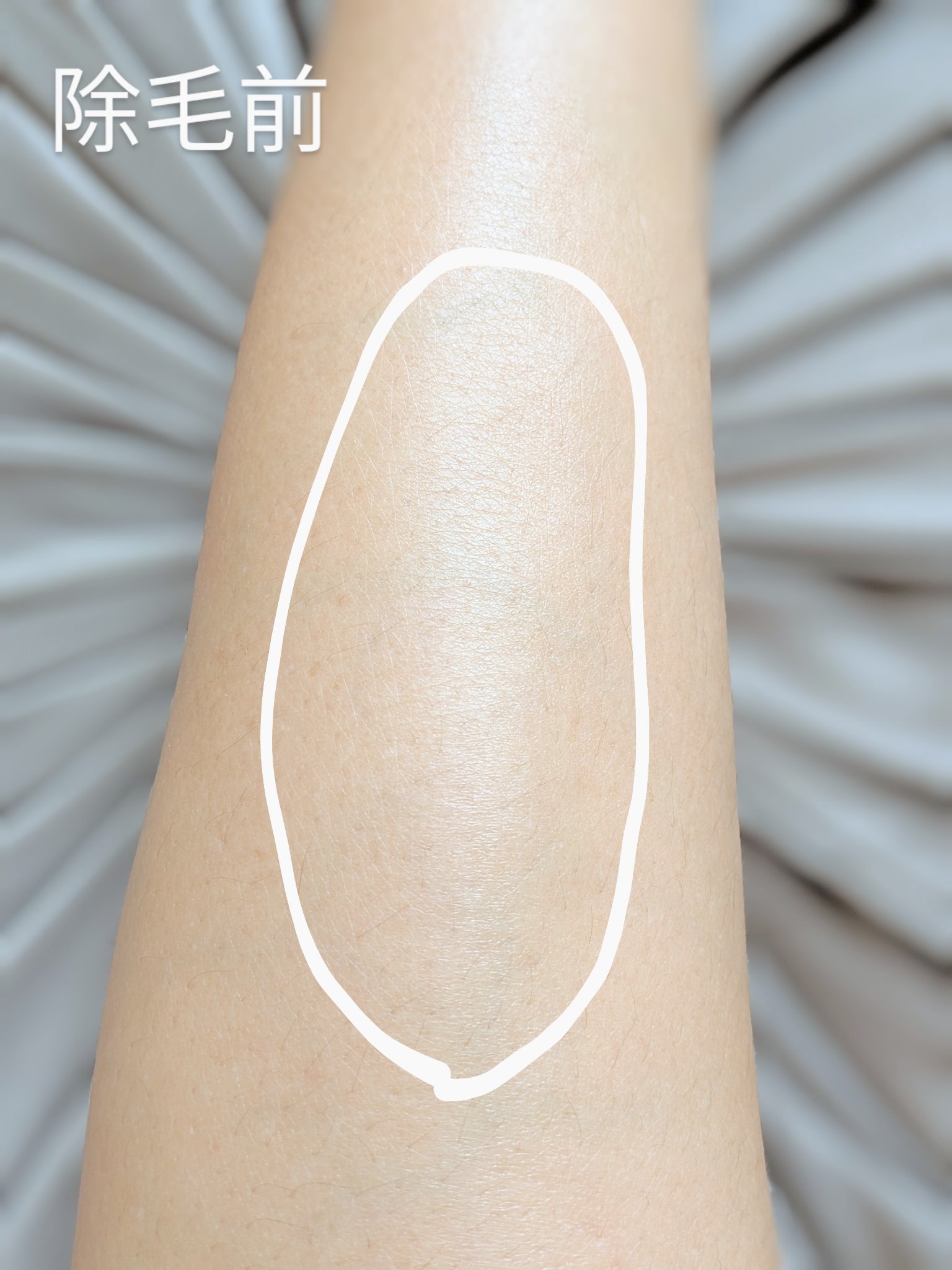 パイナップル豆乳除毛クリーム/鈴木ハーブ研究所/除毛クリームを使ったクチコミ（3枚目）