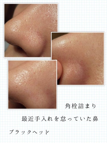 Pore control Blackhead off sheet ビューティシート/Ciracle/シートマスク・パックを使ったクチコミ（2枚目）