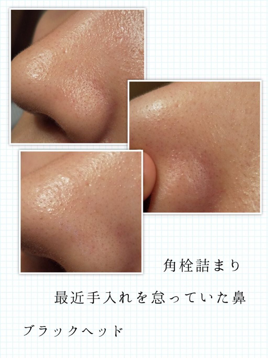 毛穴の汚れをぐいぐい溶かす!One-day's Youの鼻パック K-HOLIC ~韓国
