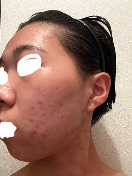 RXザ・レチノール0.1クリーム/COSRX/フェイスクリームを使ったクチコミ(3枚目)