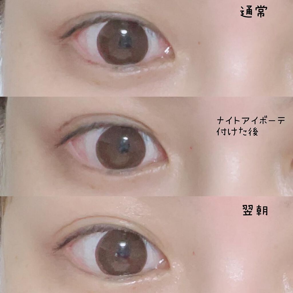 ナイトアイボーテ/StreeTrend/二重まぶた用アイテムを使ったクチコミ（2枚目）