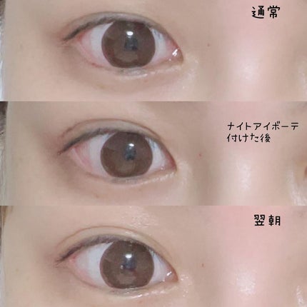 ナイトアイボーテ/StreeTrend/二重まぶた用アイテムを使ったクチコミ(2枚目)