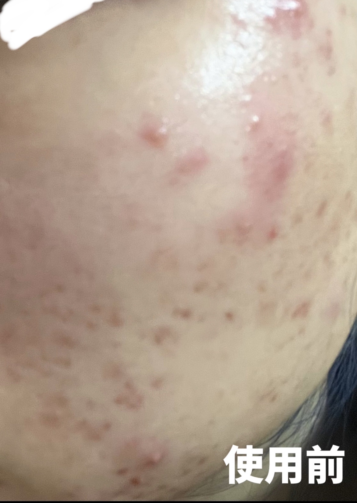 クリアフル トライアルセット L/オルビス/トライアルキットを使ったクチコミ（2枚目）