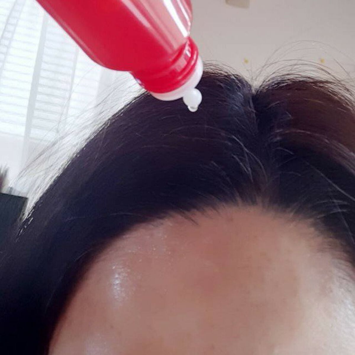 薬用 RJ地肌ケア エッセンス /アピセラピーコスメティクス/頭皮ローションを使ったクチコミ（3枚目）