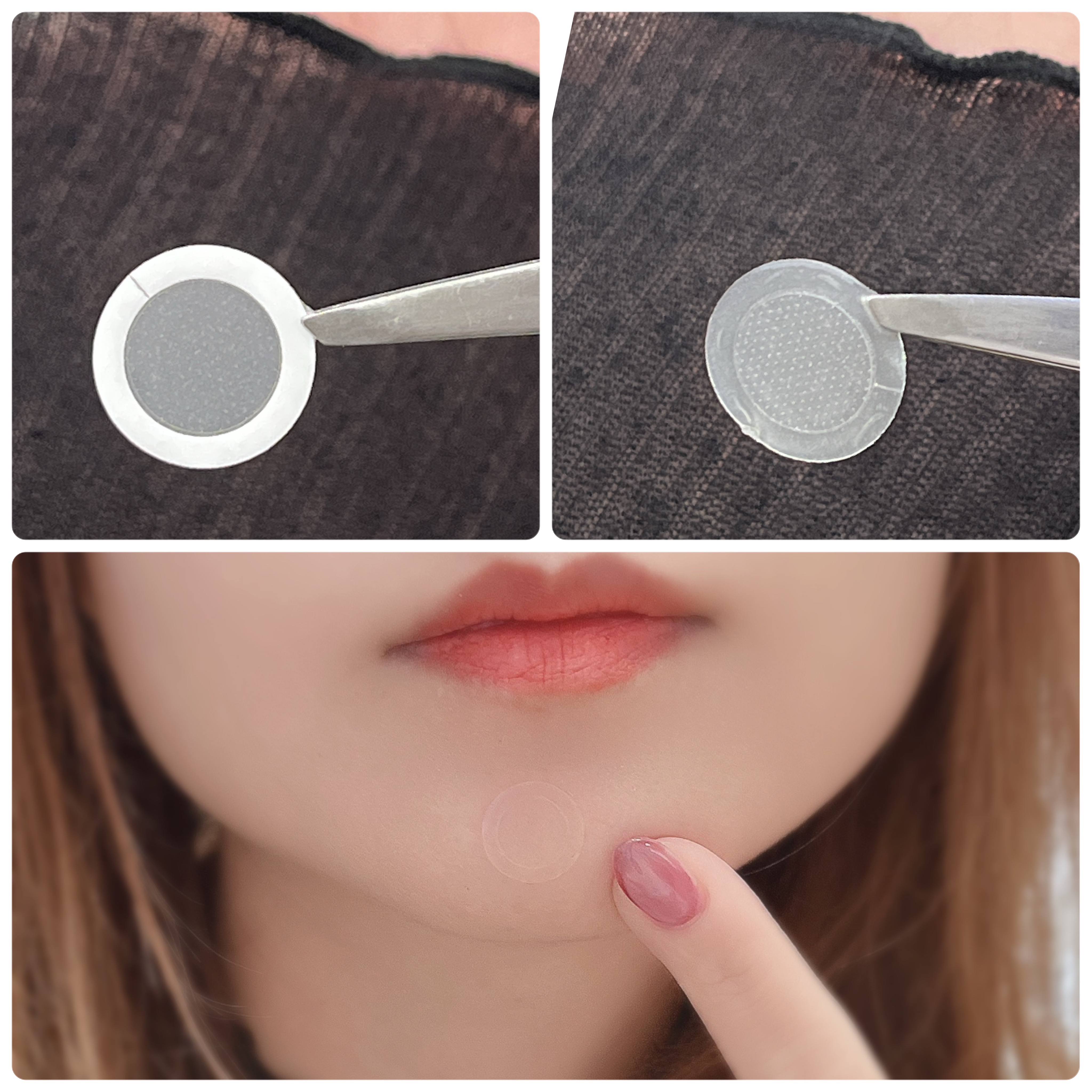 エーキュアショットスポットパッチ/obsero/にきびパッチを使ったクチコミ（3枚目）