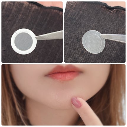 エーキュアショットスポットパッチ/obsero/にきびパッチを使ったクチコミ(3枚目)