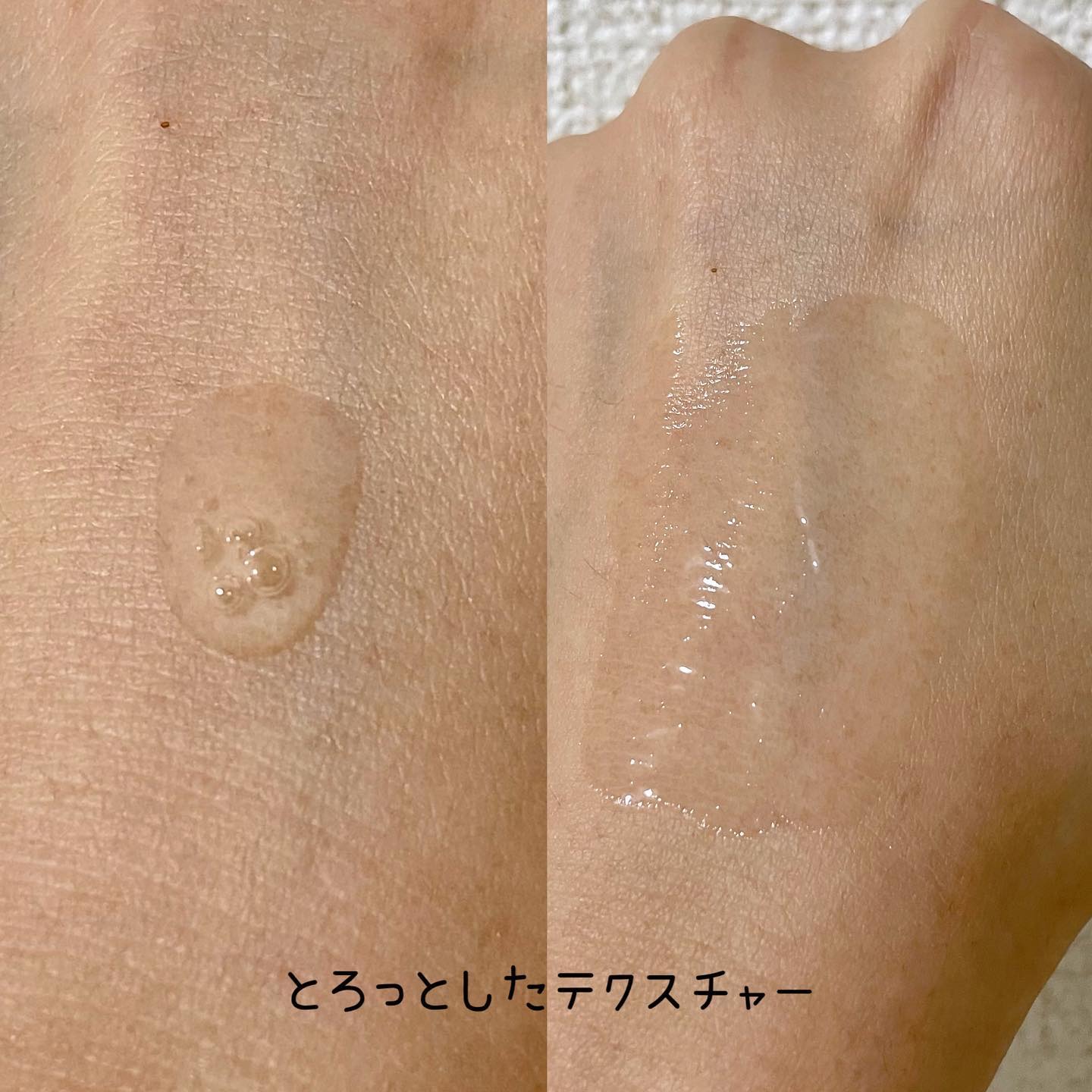 AAブレミッシュセラム/Shangpree/美容液を使ったクチコミ（3枚目）