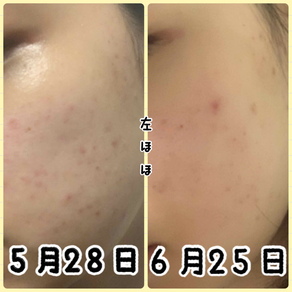 クリアターン ベイビッシュ うるおいマスク/クリアターン/シートマスク・パックを使ったクチコミ（3枚目）