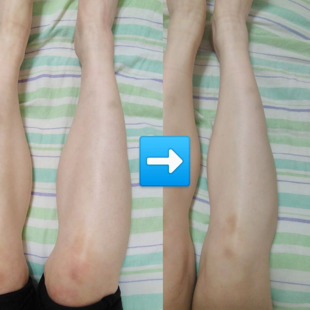 むくみぱっくん/スベルティ/健康サプリメントを使ったクチコミ（2枚目）