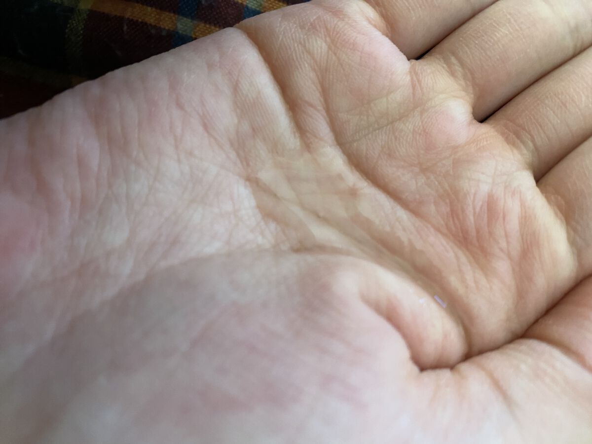 モイスチャーローションミニ/ライスフォース/化粧水を使ったクチコミ（2枚目）