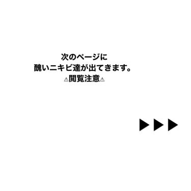 ニキビあとケアジェル/アットノン/その他スキンケアを使ったクチコミ（2枚目）