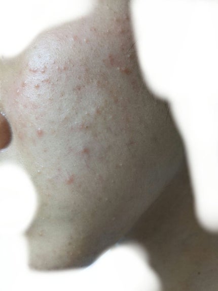 チョコラBBジュニア(医薬品)/チョコラBB/その他を使ったクチコミ(3枚目)