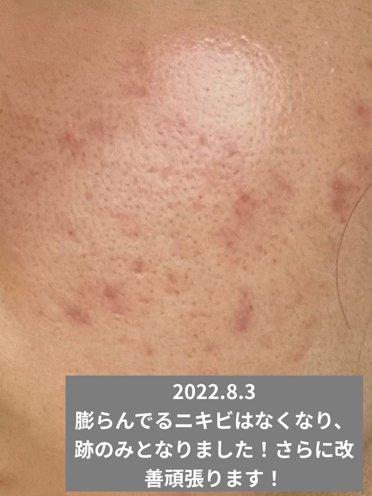 UVイデア XL プロテクショントーンアップ ローズ/ラ ロッシュ ポゼ/日焼け止めクリームを使ったクチコミ(3枚目)