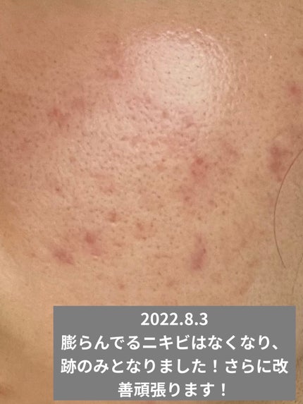 UVã€ã㢠XL ãããã¯ã·ã§ã³ããŒã³ã¢ãã ããŒãº/ã© ããã·ã¥ ããŒ/æ¥çŒãæ¢ãã¯ãªãŒã ã䜿ã£ãã¯ãã³ãïŒ3æç®ïŒ