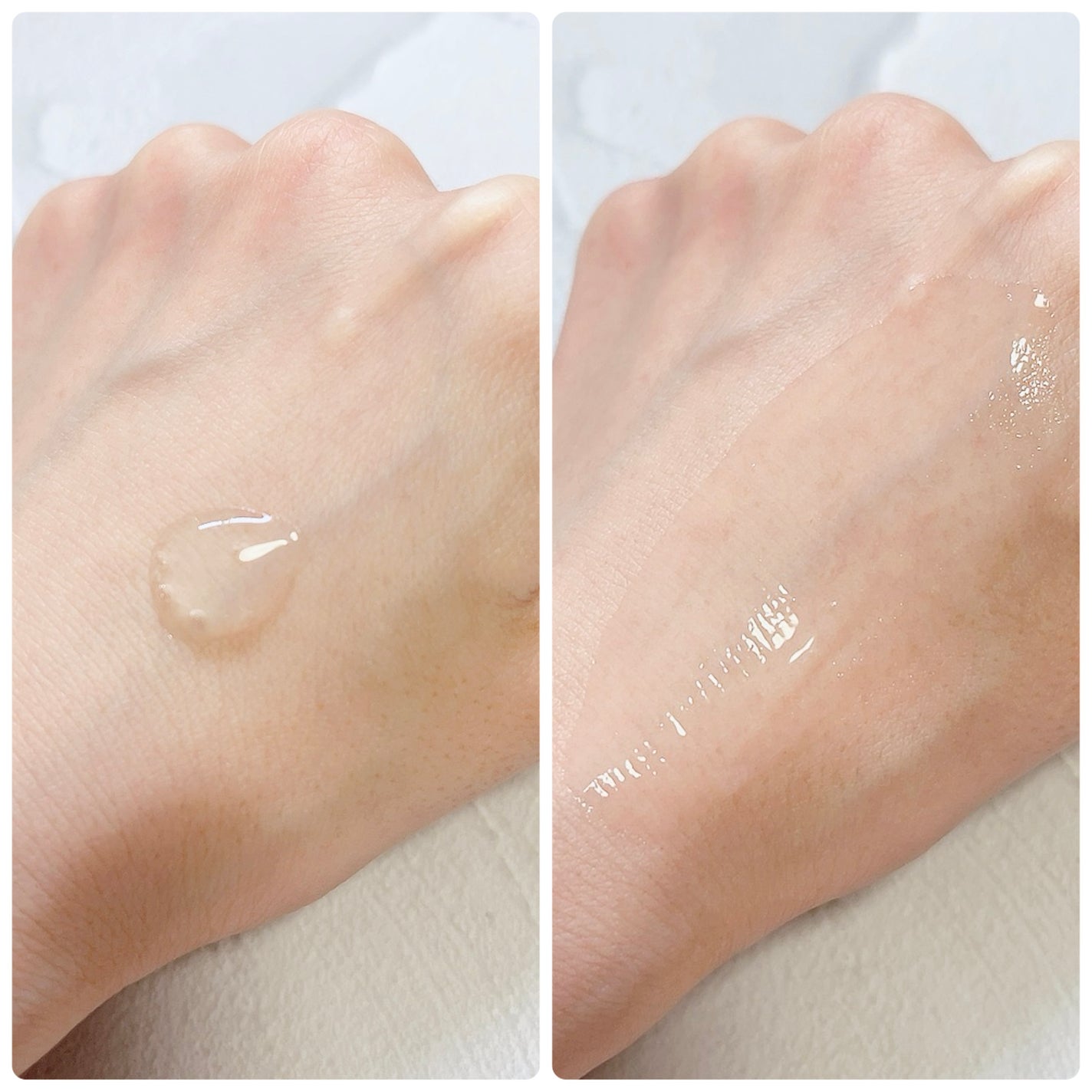 リマージ糸リフティングアンプル/REVENIP/美容液を使ったクチコミ(3枚目)