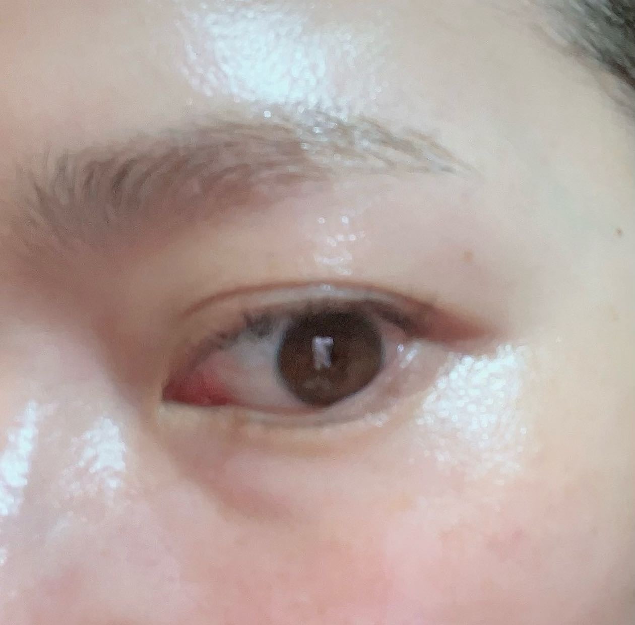 リンクルアプローチEX/エクイタンス/フェイスクリームを使ったクチコミ(5枚目)