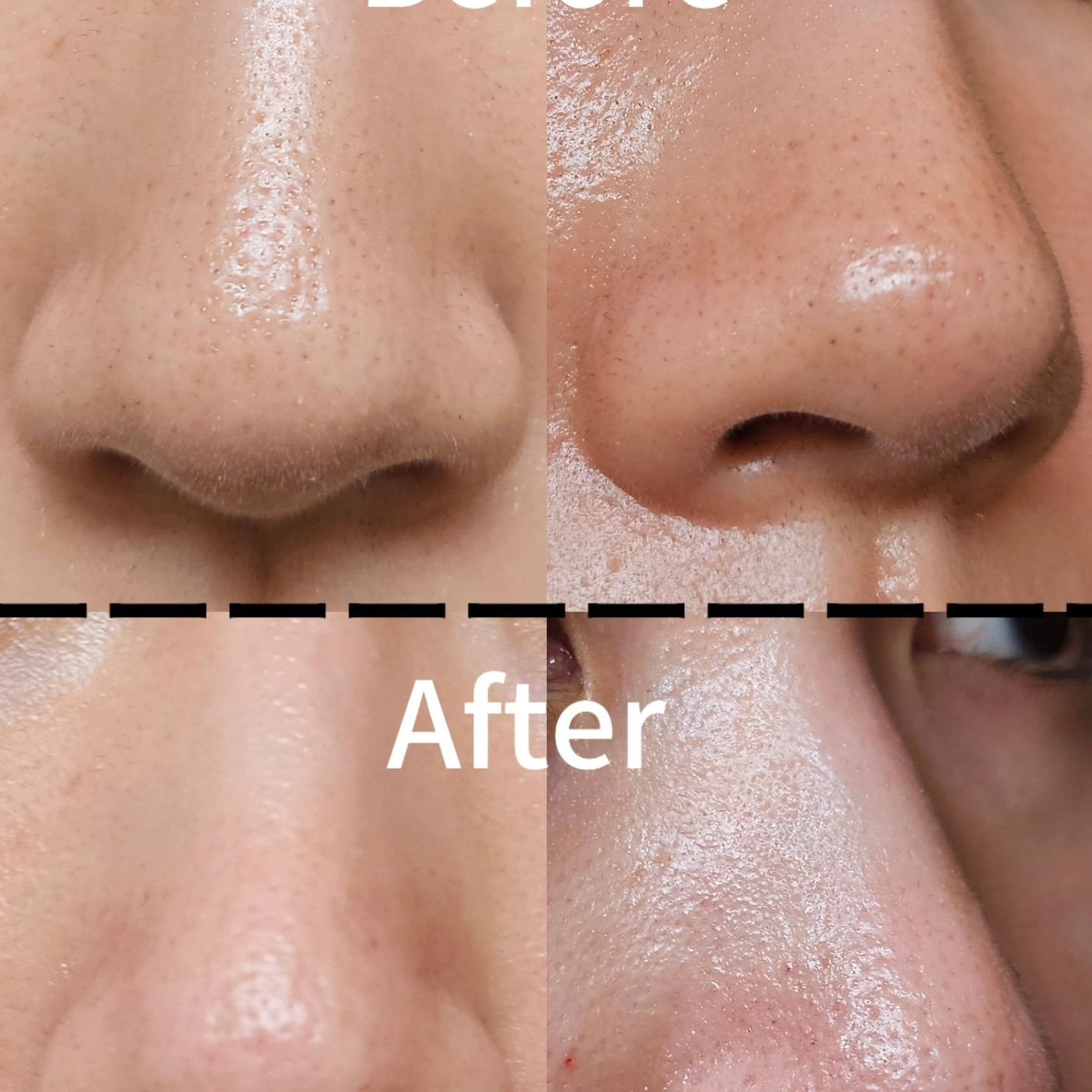 WEEEDクリアスムーズ ポアサクション/WEEED/その他スキンケアグッズを使ったクチコミ(10枚目)