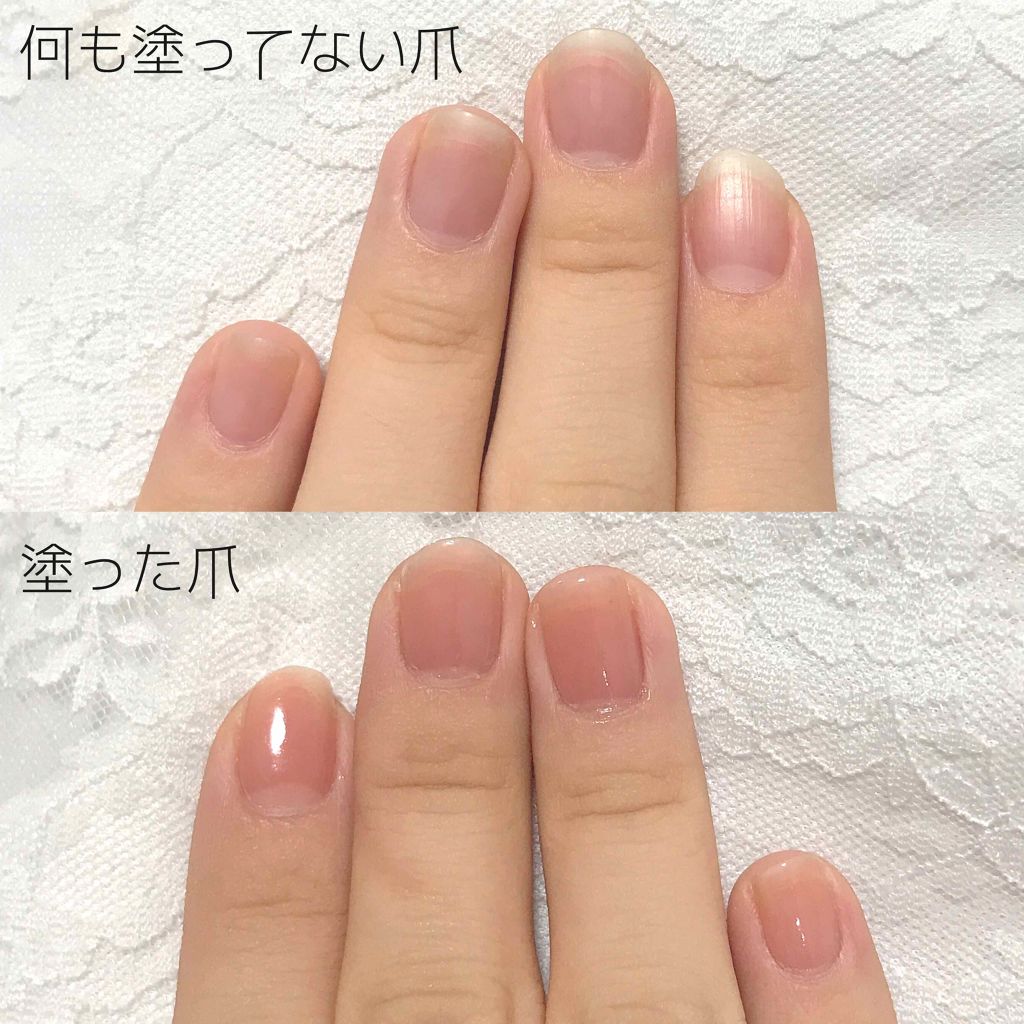 ネイルサポート ピンク/ネイルネイル/ネイルベースコートを使ったクチコミ(2枚目)