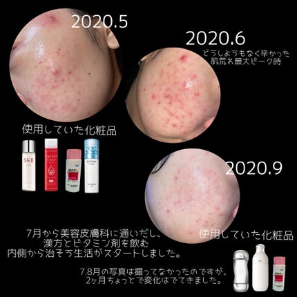 モイストバランス ローション/ACSEINE/化粧水を使ったクチコミ(4枚目)