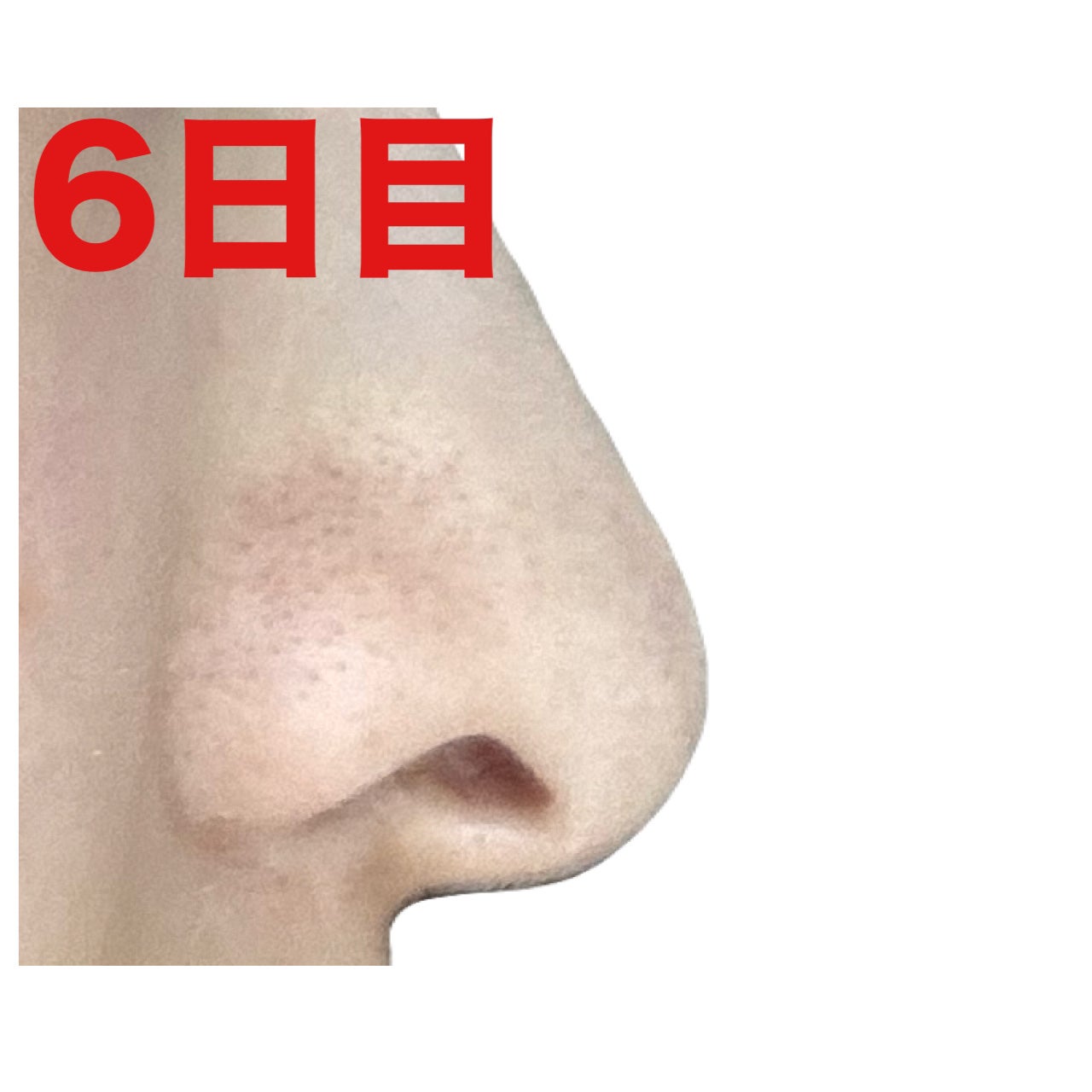 薬用 しみ 集中対策 美容液/メラノCC/美容液を使ったクチコミ(9枚目)