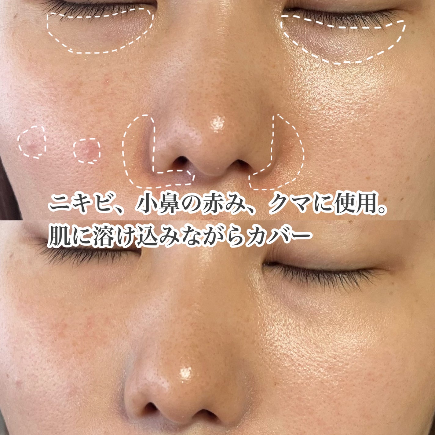 コントロールコンシーラー/MIRIMU/コンシーラーを使ったクチコミ(9枚目)