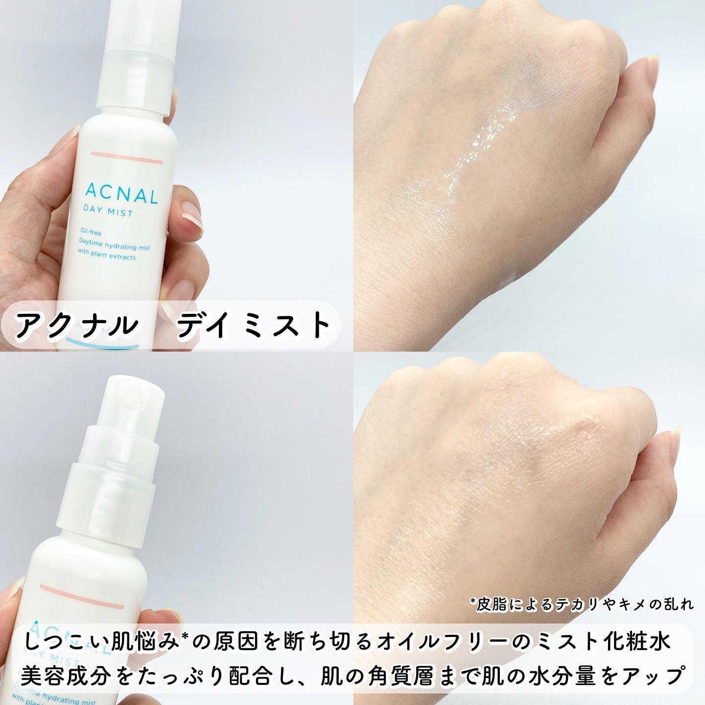 デイミスト/ACNAL/ミスト状化粧水を使ったクチコミ（3枚目）