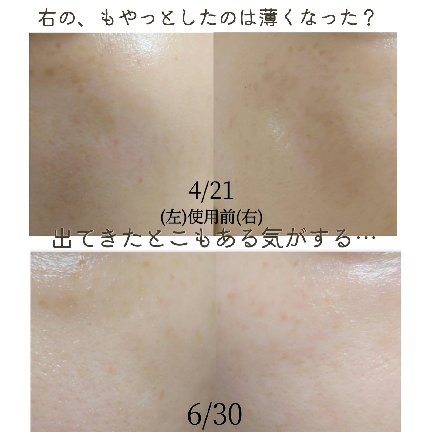 ハイドロクリームPHQ-5/KISO/フェイスクリームを使ったクチコミ(4枚目)