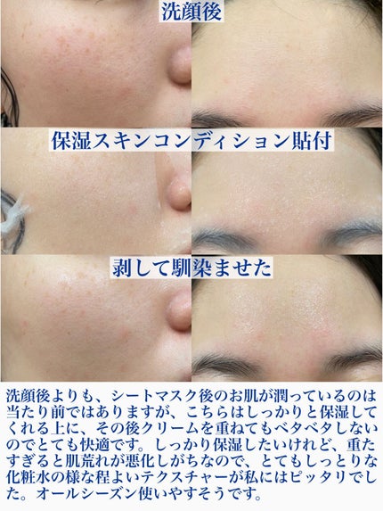 薬用ルルルン 保湿スキンコンディション/ルルルン/シートマスク・パックを使ったクチコミ(3枚目)