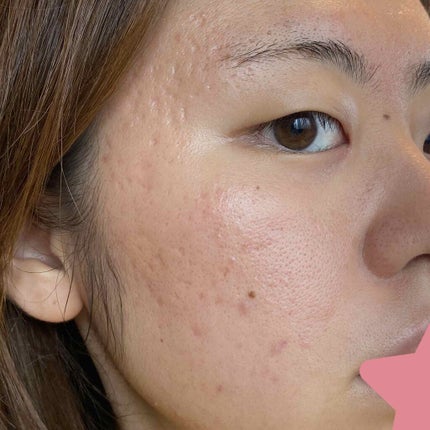 化粧水・敏感肌用・しっとりタイプ/無印良品/化粧水を使ったクチコミ(3枚目)