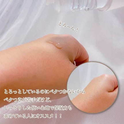 オルビスユー エッセンスローション /オルビス/化粧水を使ったクチコミ(3枚目)