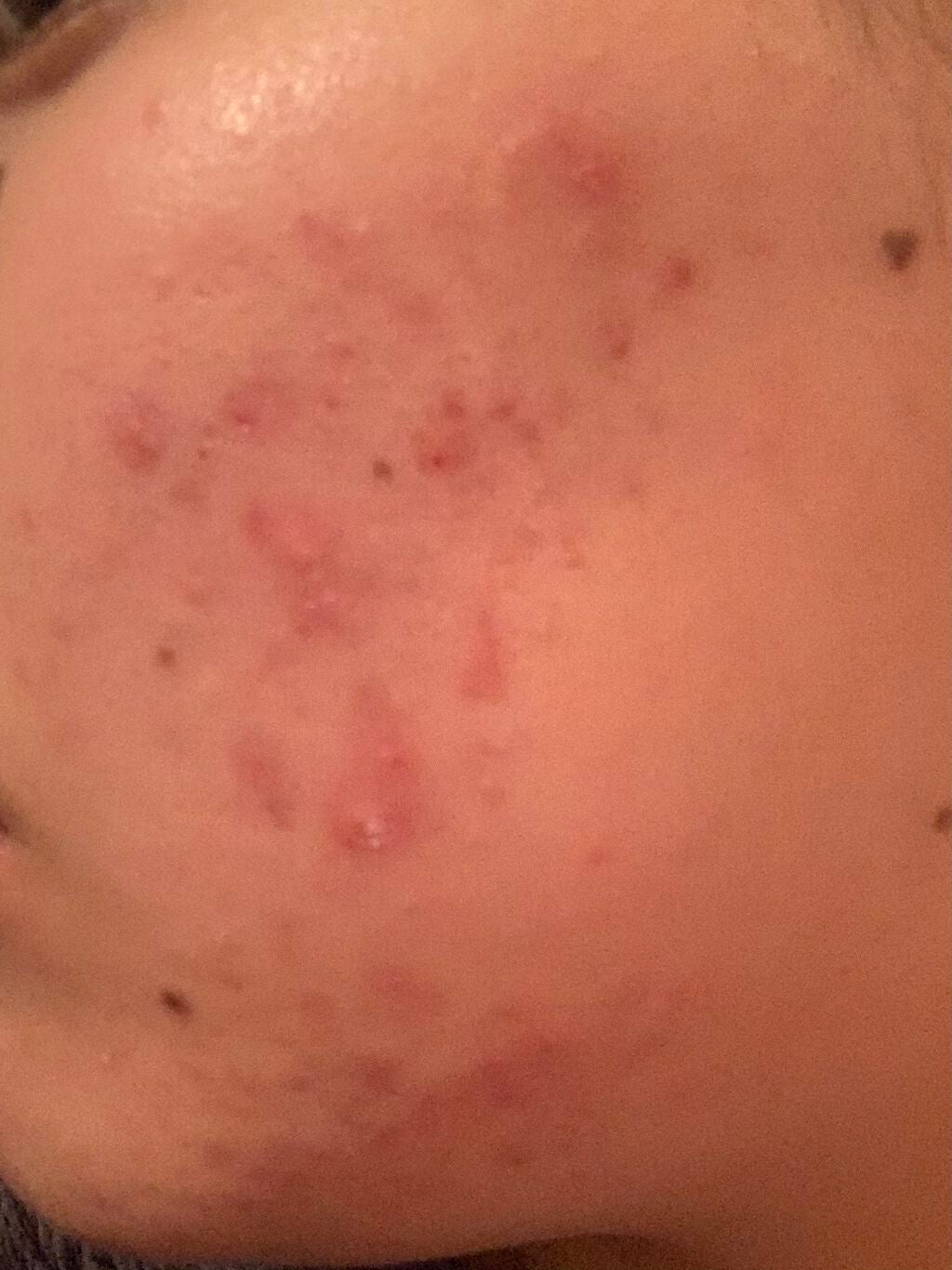 とろり on LIPS 「ちょっと照明が茶色いとこで撮ってしまったせいでサウナあがりみた..」(2枚目)