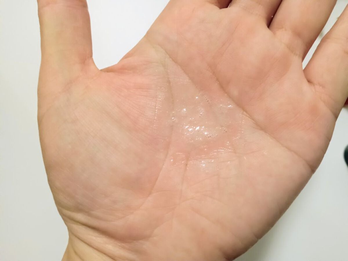 薬用スカルプセラム/wicot/頭皮ローションを使ったクチコミ(4枚目)