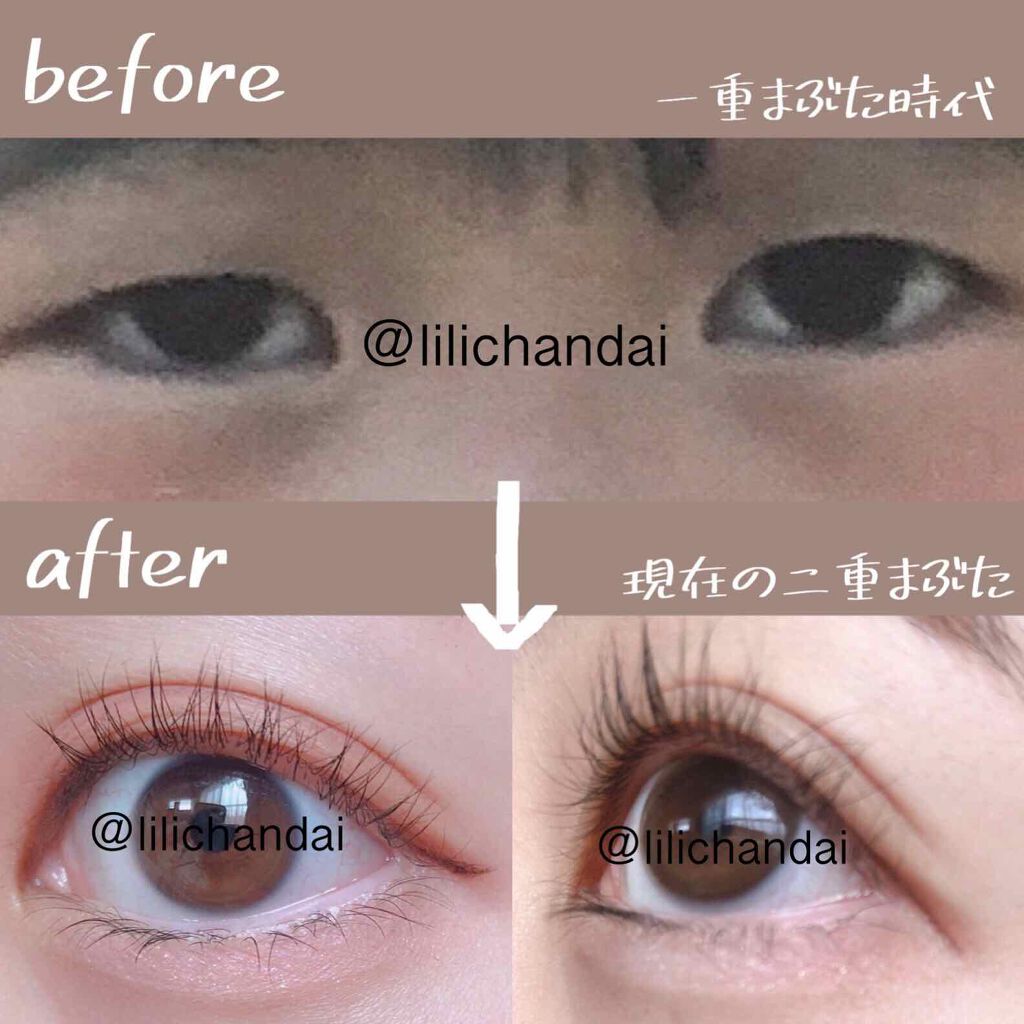 アイトーク/アイトーク/二重まぶた用アイテムを使ったクチコミ(2枚目)