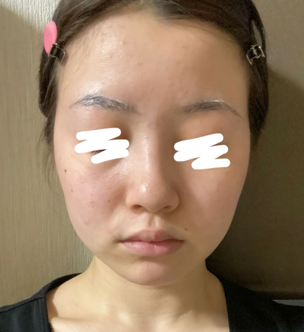 DHC 亜鉛/DHC/健康サプリメントを使ったクチコミ（2枚目）