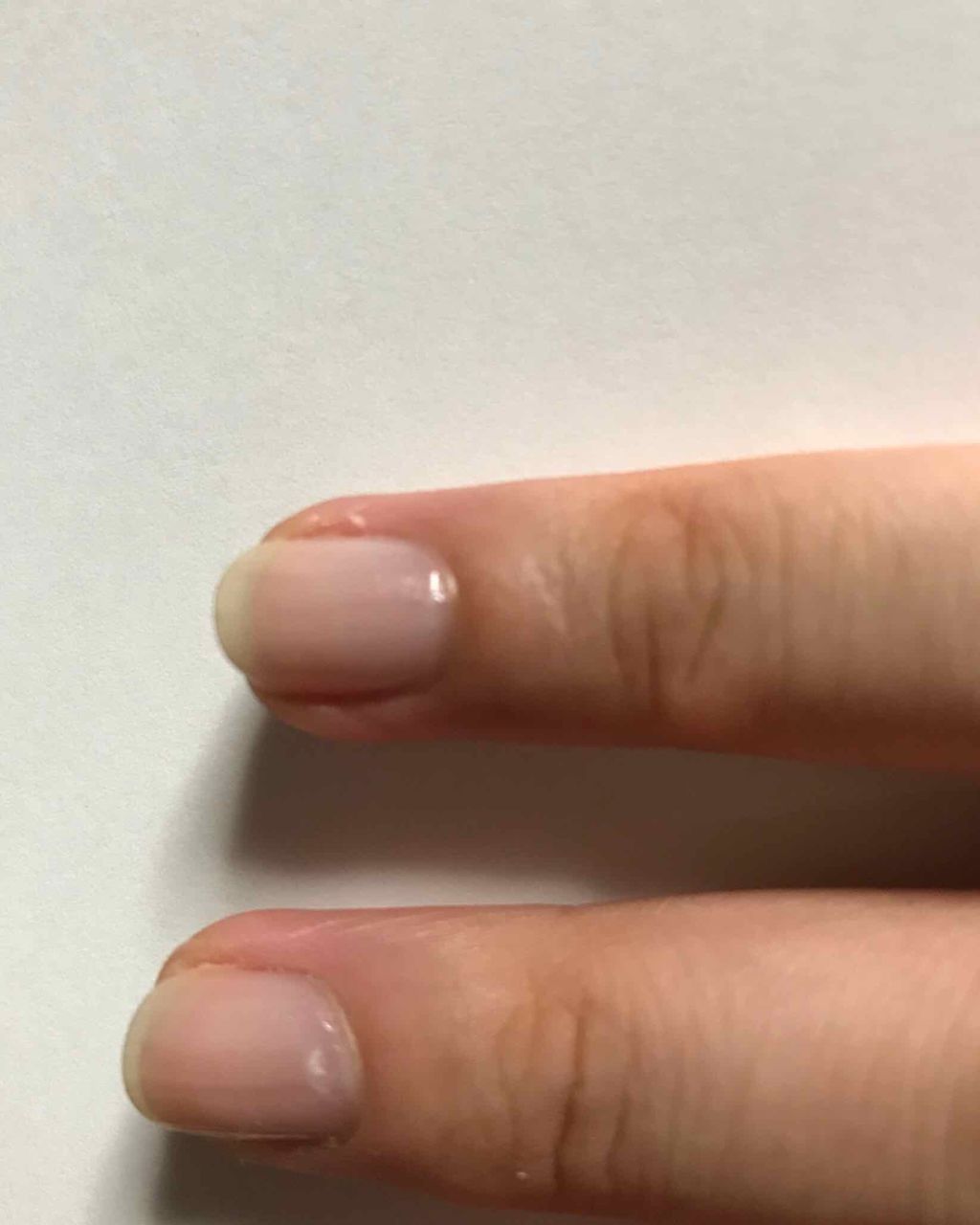 ジェル リハブ トリートメント/nails inc./ネイルベースコートを使ったクチコミ(3枚目)