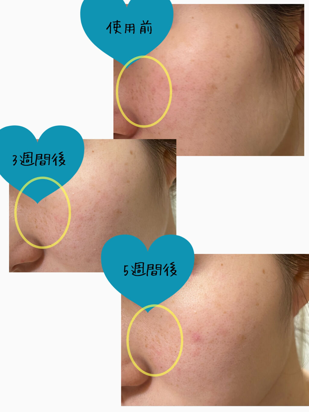 クリスタル インテンシブ ホワイトニング クリーム/TOSOWOONG/フェイスクリームを使ったクチコミ（3枚目）