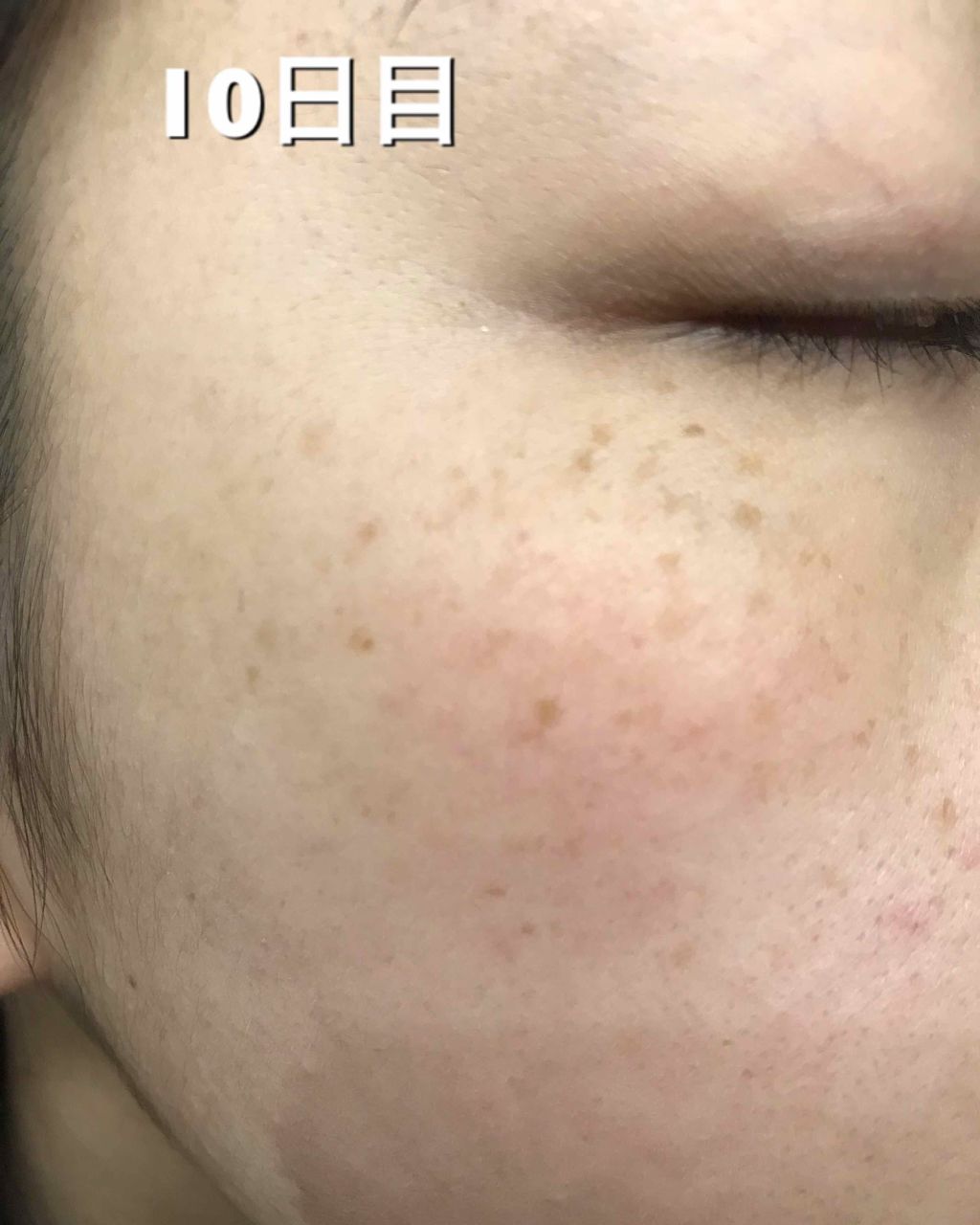 敏感肌用薬用美白美容液/無印良品/美容液を使ったクチコミ(3枚目)