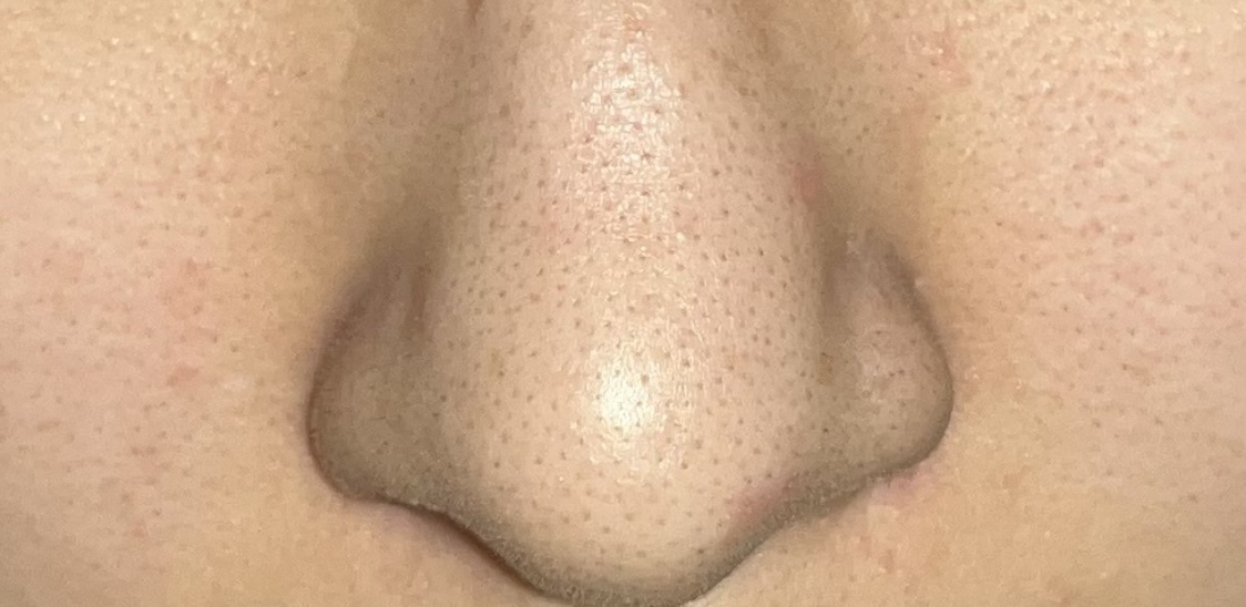 ノーモアブラックヘッド(ノーズピーリング)/One-day's you/スクラブ・ゴマージュを使ったクチコミ（2枚目）