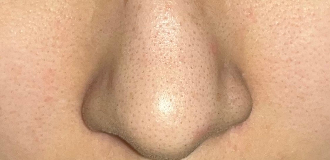 ノーモアブラックヘッド(ノーズピーリング)/One-day's you/スクラブ・ゴマージュを使ったクチコミ(2枚目)