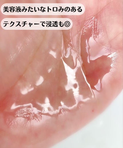 VC100エッセンスローション EX/ドクターシーラボⓇ/化粧水を使ったクチコミ(2枚目)