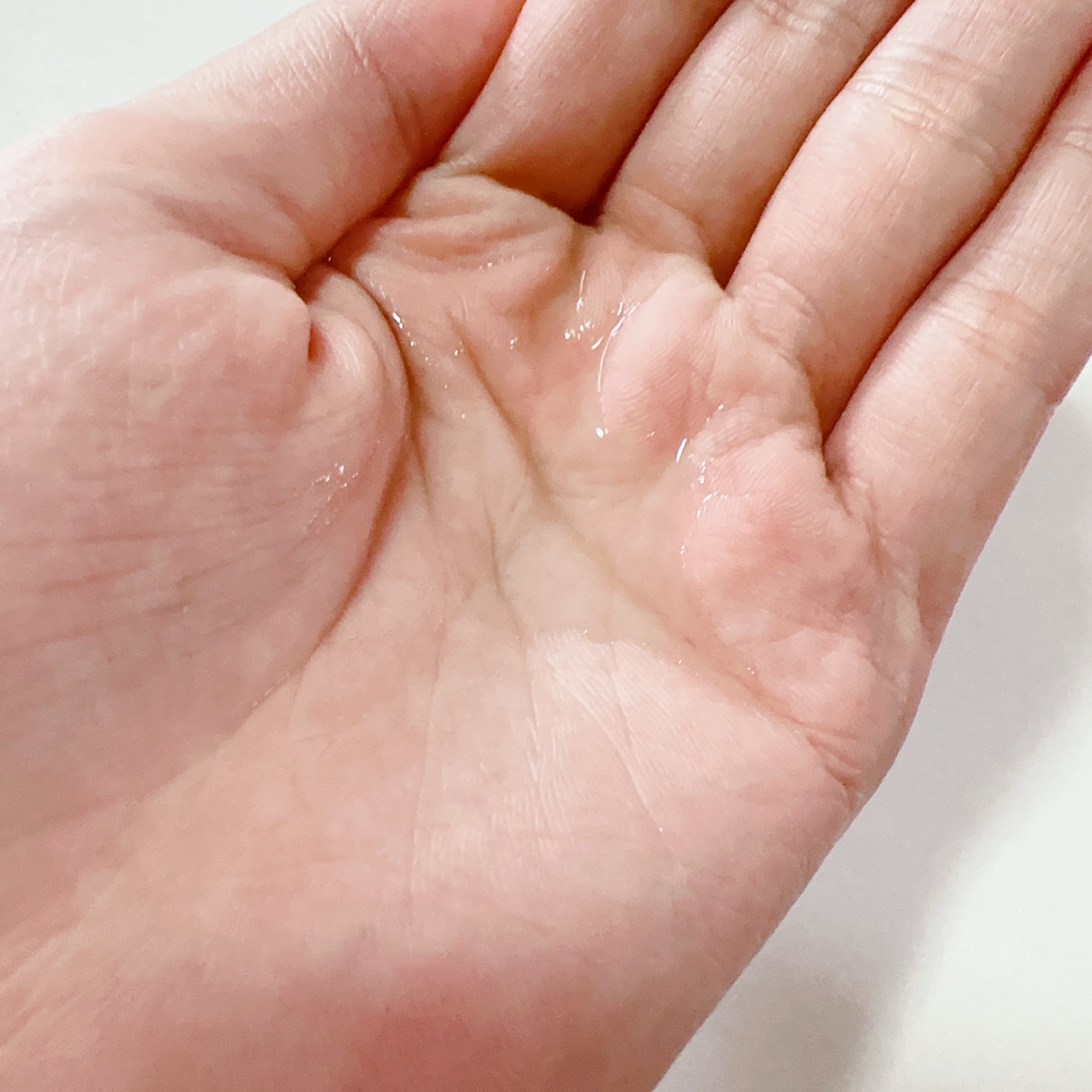 ティーツリーバイオームブレミッシュシカトナー/MEDIHEAL/化粧水を使ったクチコミ（3枚目）