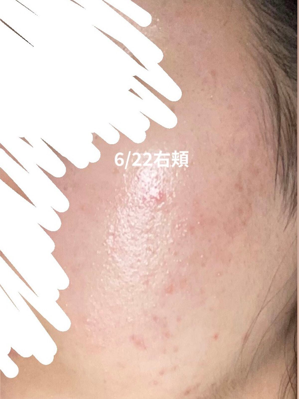 白潤 薬用美白乳液/肌ラボ/乳液を使ったクチコミ(3枚目)