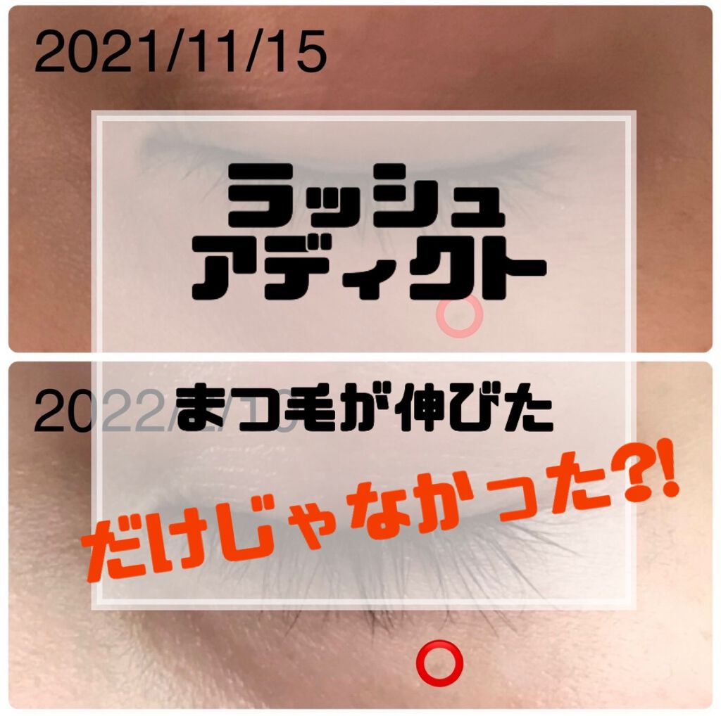 ラッシュアディクト アイラッシュコンディショニングセラム/soaddicted/まつげ美容液を使ったクチコミ（1枚目）